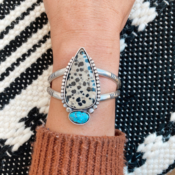 CUFF UPGRADE